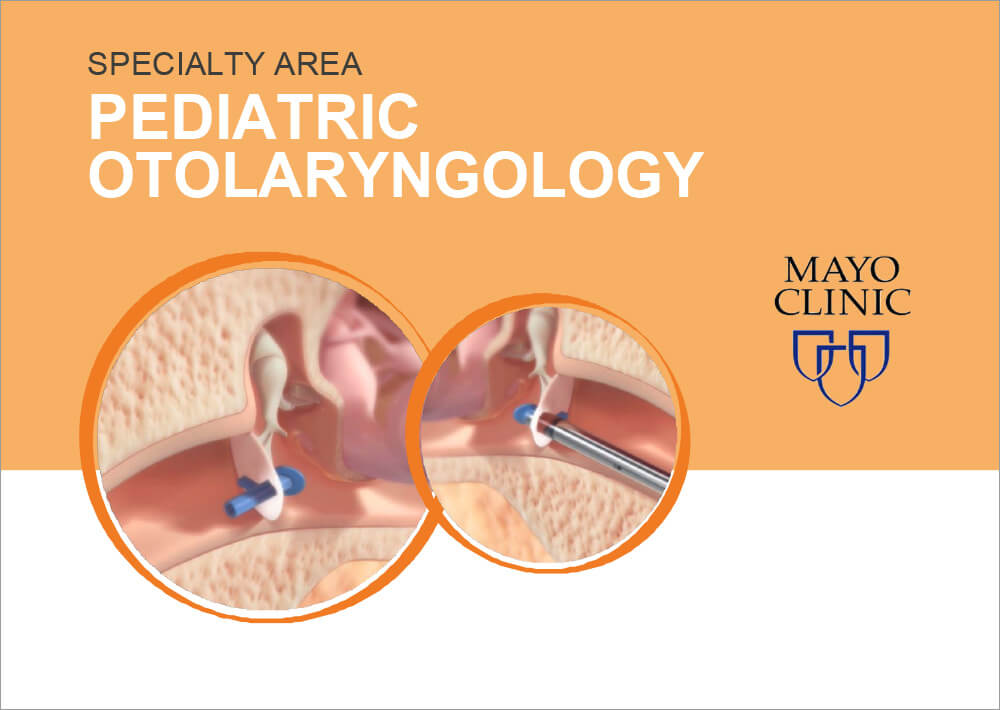 Mayo Clinic Tolerability Profile of In-Office Tympanostomy Tube Insertion