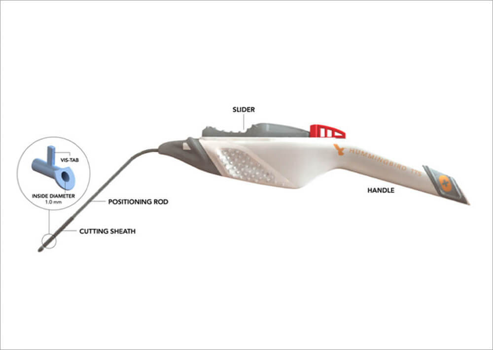 Hummingbird Device for Ear Tube Placement: Interview with Steve Anderson, CEO of Preceptis Medical