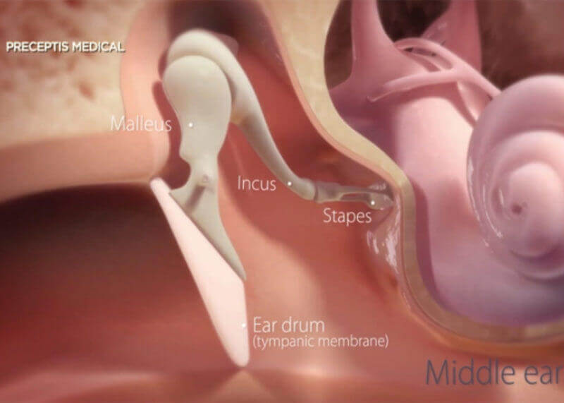 ear canal with the Ear drum, Malleus, Incus, and Stapes labelled
